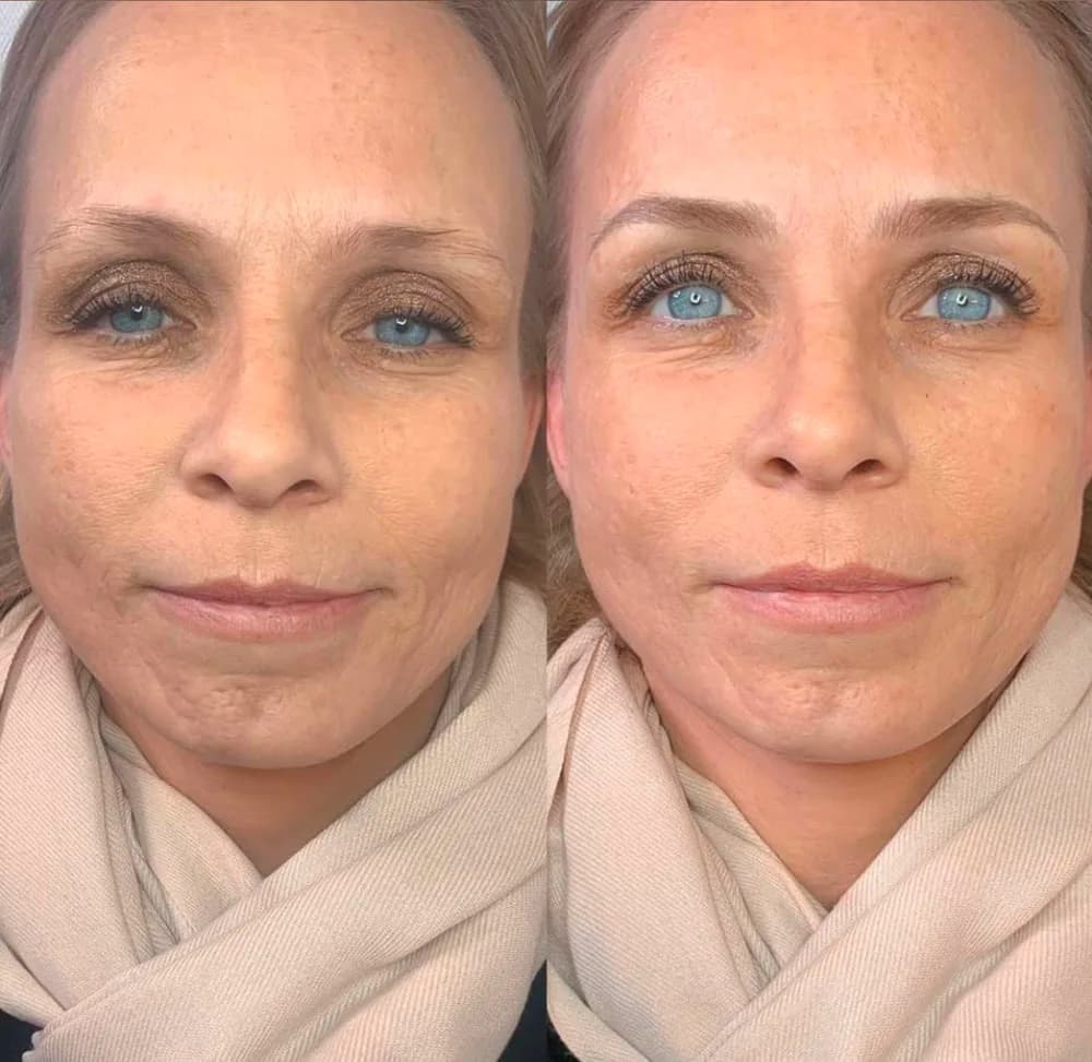 PMU resultat kvinner – vakkert og naturlig permanent makeup hos SOMI Klinikken